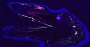 New research on limb regeneration | &laquo; previous thread