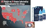 OT.   Bad Eyedrops,  Major Suppliers | 