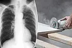 Fancy quartz countertops are killing people who make them, doctors say | next thread &raquo;