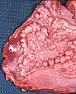 Asbestos in early Artex?  |  Yes. But you need crossed polarisers to see if it is crystalline rather  than an...