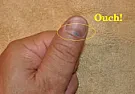 Rat trap: Snapped on my finger today (yellow plastic paddle trigger is too sensitive)  |  I've got the mouse sized traps and noted they are sensitive and had to  bend...