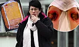 DIY mum left with horrific burns | ...
