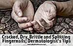 Split fingernail.  | &laquo; previous thread