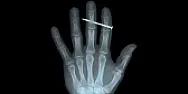 nail gun fun? | ...