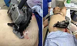 Man Survives Saw In Stomach - Shocking Image  | http://news.sky.com/story/1103590/man-survives-saw-in-stomach-shocking-image 
